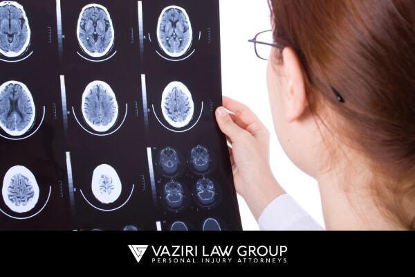 Factors influencing TBI settlemenet amount