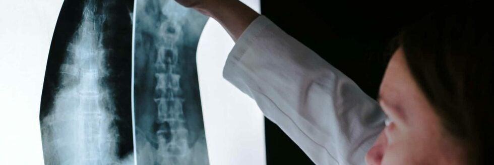 Spine Injury from a Car Accident: What You Need to Know