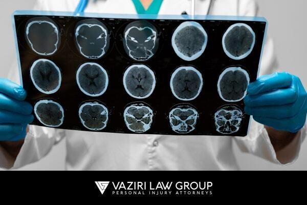 Types of Brain Injuries We See