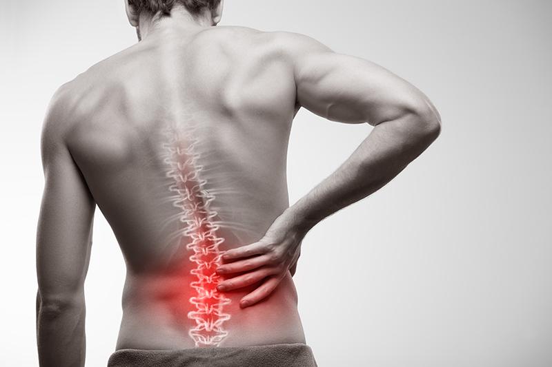 How Much Is the Average Settlement for a Back Injury?